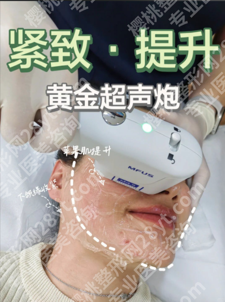 黄金超声炮能维持多久?3个月就松了,因为90%人没做好这3件事