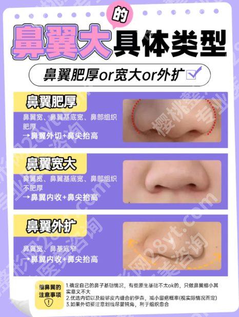 缩鼻翼外切太多了能接回去吗?分2种情况说清