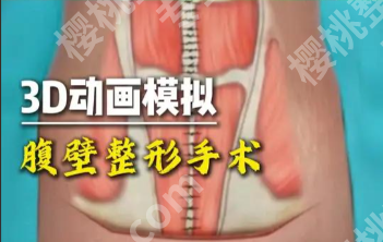 郑州腹壁整形手术厉害的三个医院:真实案例,看完不纠结