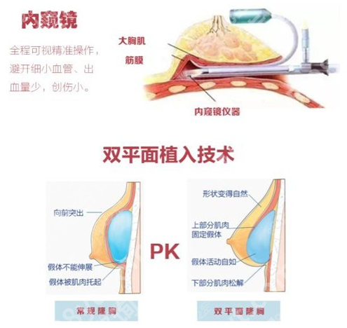 上海第九人民医院隆胸要排队多久?内行人揭秘,时间差竟差3个月