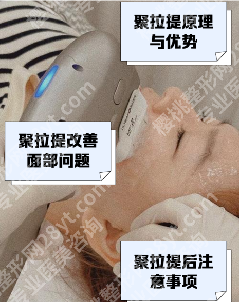 聚拉提有什么效果和副作用? 3大核心效果,数据+案例说话