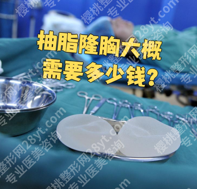 杭州浙二医院自体脂肪隆胸费用:2.5万起,附医生报价+省钱攻略