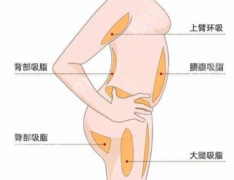水动力吸脂的切口大小怎么样?怕留疤的姐妹,看完这篇不用慌