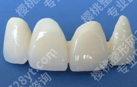 洗牙一次大概价格多少?费用一般都是280元左右