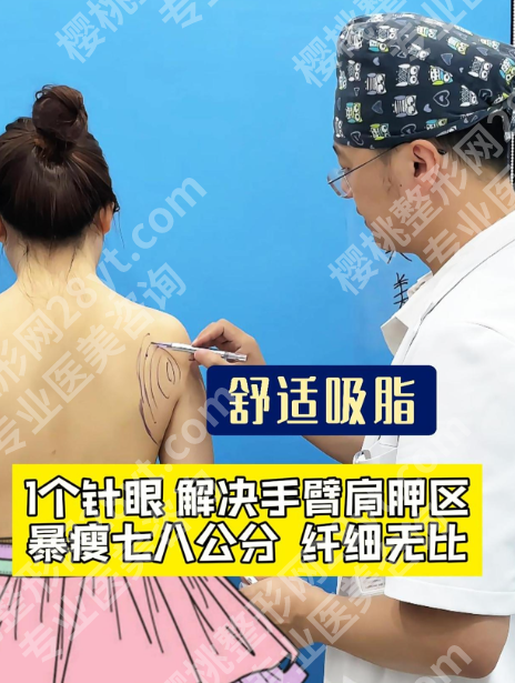 肩胛骨吸脂多少钱?价格从5k到 3w,差在哪?