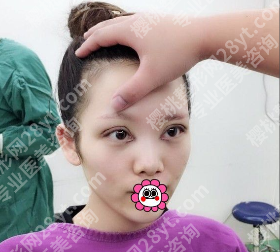 哈尔滨瑞丽哪个大夫割双眼皮好?3个硬标准比“名气”靠谱10倍
