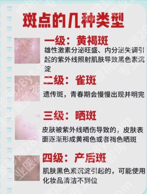哈尔滨瑞丽祛斑好吗?4大硬核维度+真实案例,揭秘东北祛斑实力派真相