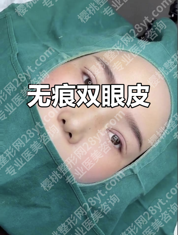 定点双眼皮和纳米无痕双眼皮的区别:2张表分清差异!3个真人案例教你选对不踩雷