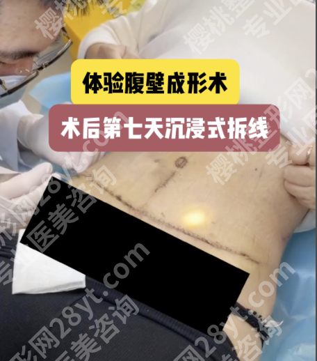 南京腹壁整形手术哪里做的好?3家TOP机构+2份硬核数据,帮你精准避坑