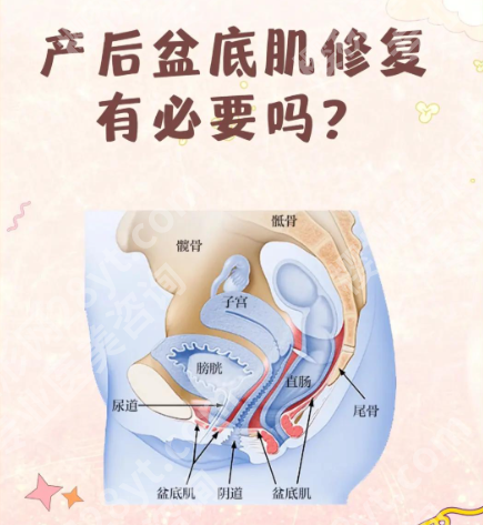 私密热玛吉可以修复盆底肌吗?2类人群实测+数据,产后妈妈必看