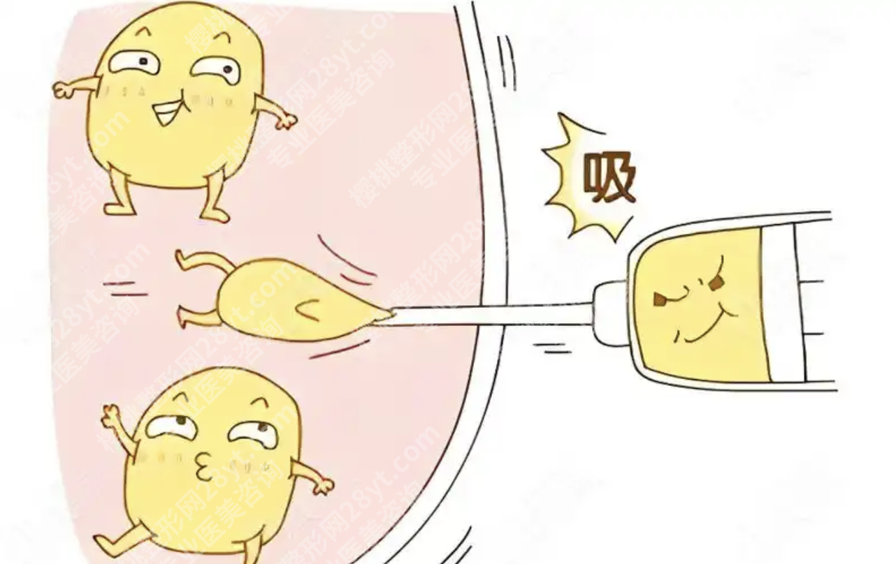 临沂吸脂好的医院排名:5家正规公立机构详解,附价格
