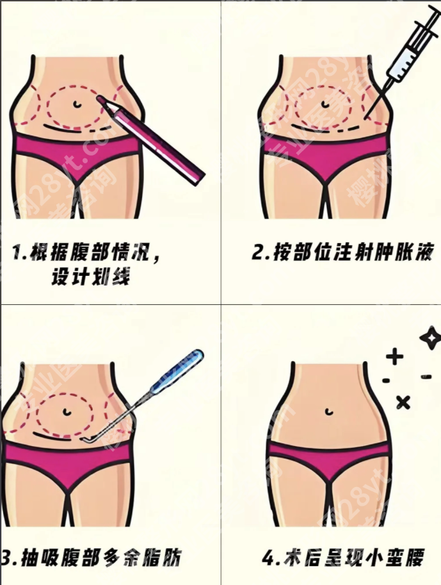 昆明抽脂肪去哪个医院?内行人揭秘6家宝藏机构