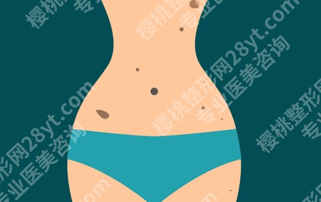 厦门吸脂专家排名榜,腰腹/大腿/手臂塑形口碑医生推荐,附大致费用区间