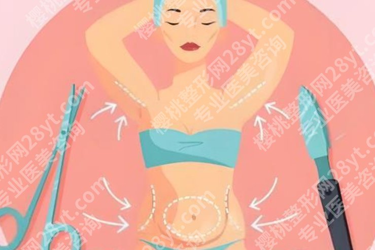 哈尔滨吸脂哪家医院好?机构资质、麻醉安全和术后管理对比分析