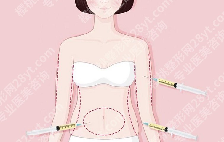 无锡吸脂塑形哪里好?几家口碑医院对比,告诉你差别有多大