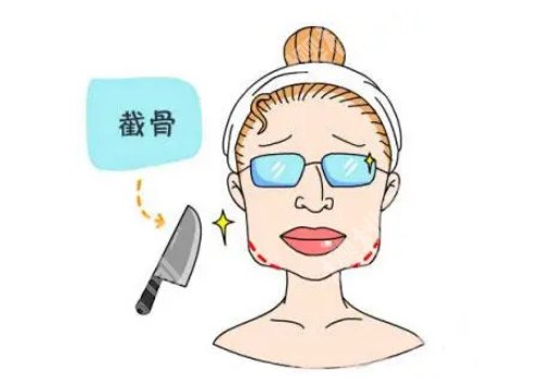上海九院磨骨有名的医生:余东、柴岗、刘凯真实水平实测!就诊必看