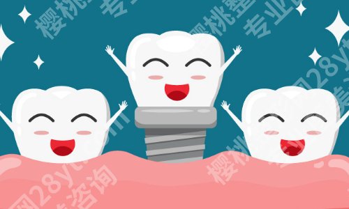 上海第九人民医院种牙怎么样?方式多样化、技术实力高