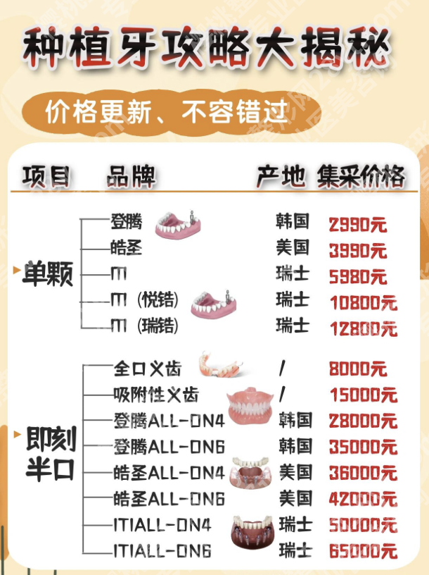 北医三院种植牙齿价格真相:为啥有的植体贵3倍?不是智商税