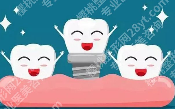 上海九院种植牙价目表!一文看懂种牙预算、项目、医生等重点!