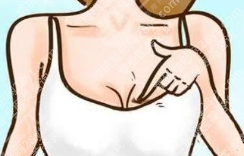 上海九医院假体隆胸多少钱?手术费用构成,新手必看避坑解析
