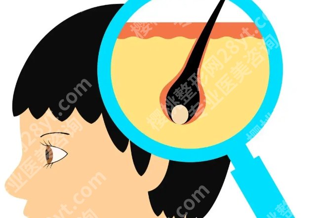 西京医院植发效果怎么样?真实恢复周期+成活率影响因素一次讲清