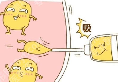 北京协和抽脂手术多少钱一次?1w起!价格表明细+人气医生曝光