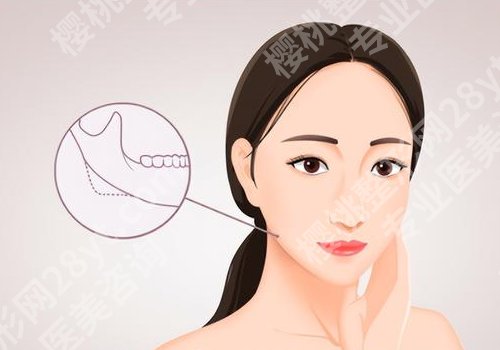 上海九院正颌科好的专家有谁?沈国芳、朱敏、张诗雷技术精湛、风格各有千秋