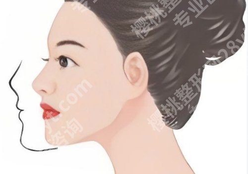西安西京医院正颌手术医院排名怎么样?技术、优势名列前茅、口碑实至名归。