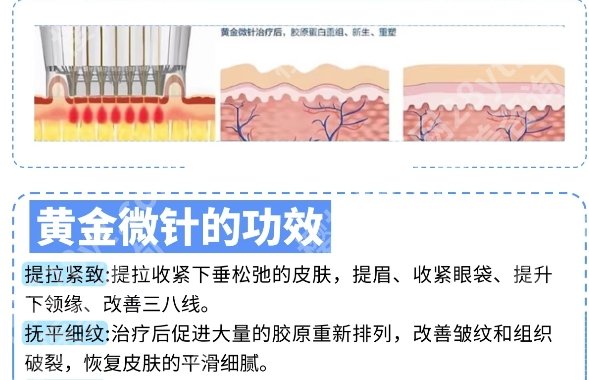 成都二医院黄金微针价格表单更新一览!院内主打项目鉴赏