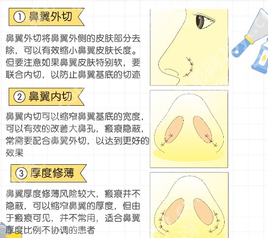 八大处整形收费标准!变美常见问题一站式掌握!