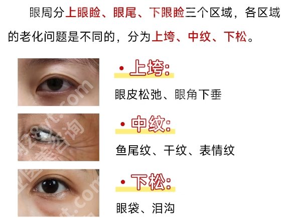 深圳北大医院整形外科擅长眼周整形吗?医院口碑点评来袭!