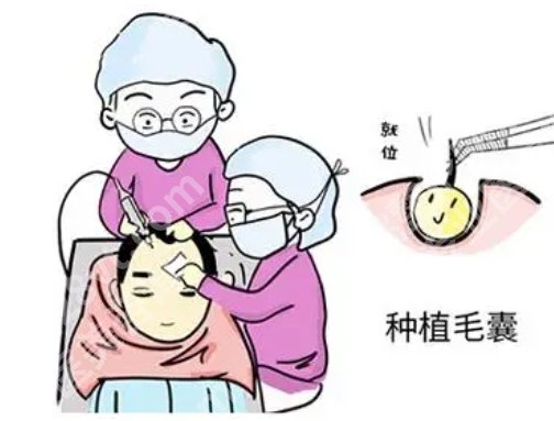 301医院植发挂什么科?相关科室信息|速看就诊指南~