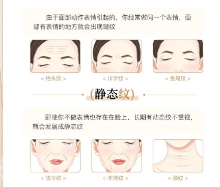 山东省立医院除皱多少钱?项目收费明细公布!消费一目了然