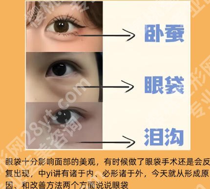 浙一割眼袋哪个医生好?沈向前、范希玲实力在线!值得信赖