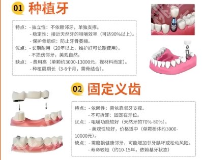 吉大一院口腔科收费标准更新!项目收费透明!术前必看