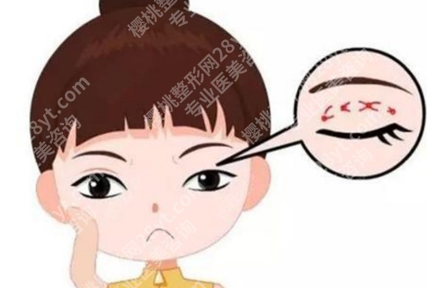 浙一医院双眼皮价格表,附埋线和切开的价格区间对比