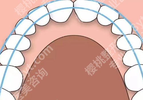 上海牙齿矫正比较好的医院有哪些?2026高性价比医院名单分享!