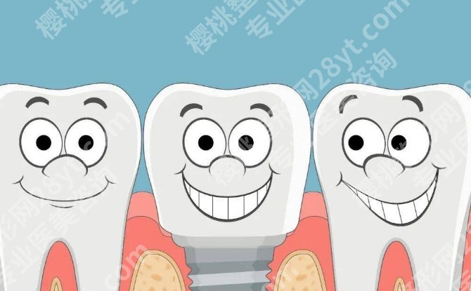 嘉兴种植牙厉害三个医院,实力对比一篇帮你看明白