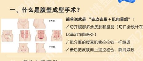 蚌埠第三人民医院腹壁整形专家有哪些?科室实力如何、医生专长解析与整形项目价格参考!