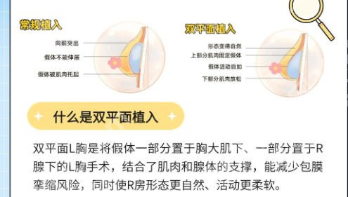 成都素美隆胸怎么样?从业超10年医生亲诊!双平面技术打造贴合女性的自然胸型!