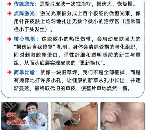 洛阳哪家医院可以做点阵激光?这几家医院实力在线等你来看!