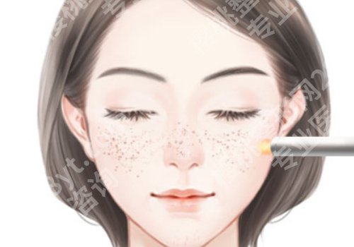 咸阳激光祛斑医院哪家好?多家公立医院上榜