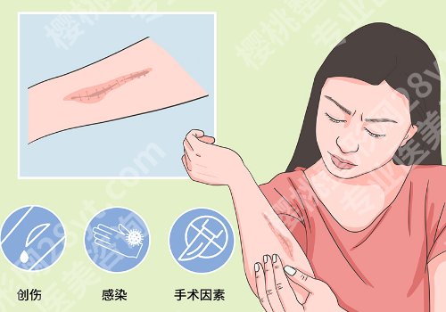 潍坊祛疤痕医院哪家好?Top榜单更新、从技术到口碑深度解析!