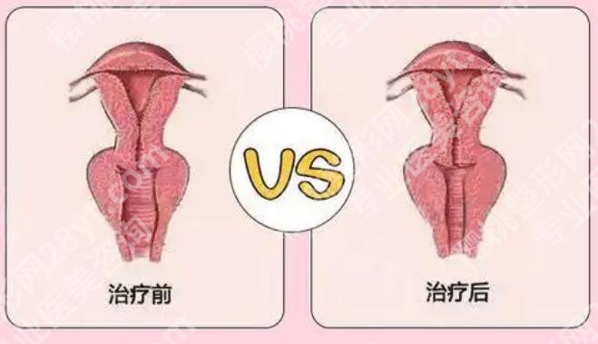 邯郸adm紧缩针哪里可以打?这份本地正规医美机构名单建议收藏