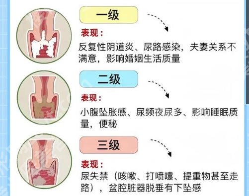 西安紧缩针在哪里预约?附2026价格表及预约指南!