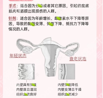 济宁adm紧缩针哪里可以打?2026医院排行榜揭晓!