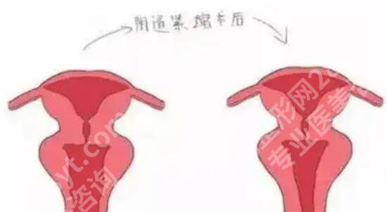洛阳紧缩针在哪里打?top榜前五名单更新!收藏再看