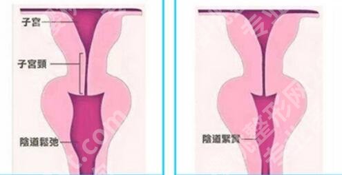 长春紧缩针在哪里能打?2026医院排行榜公布!各个实力高!