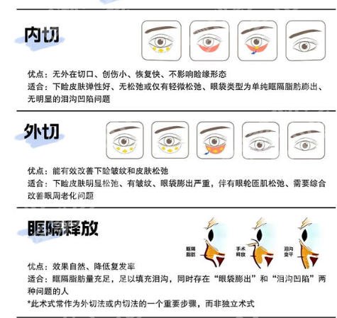 上海三甲医院祛眼袋怎么样?5家公立医院资料在线看