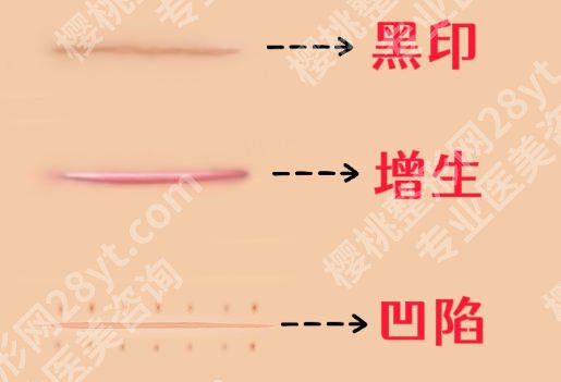 重庆西南医院祛疤痕怎么样?医生信息与擅长案例推荐!